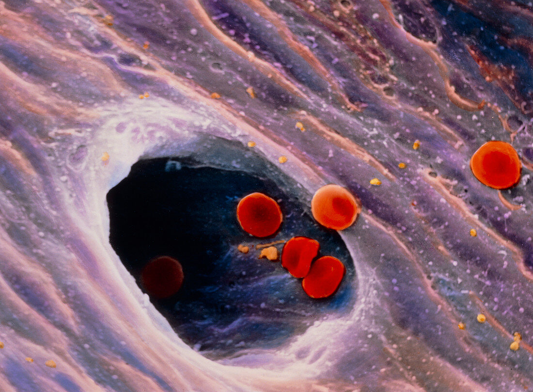 Coloured SEM of red blood cells in blood vessel