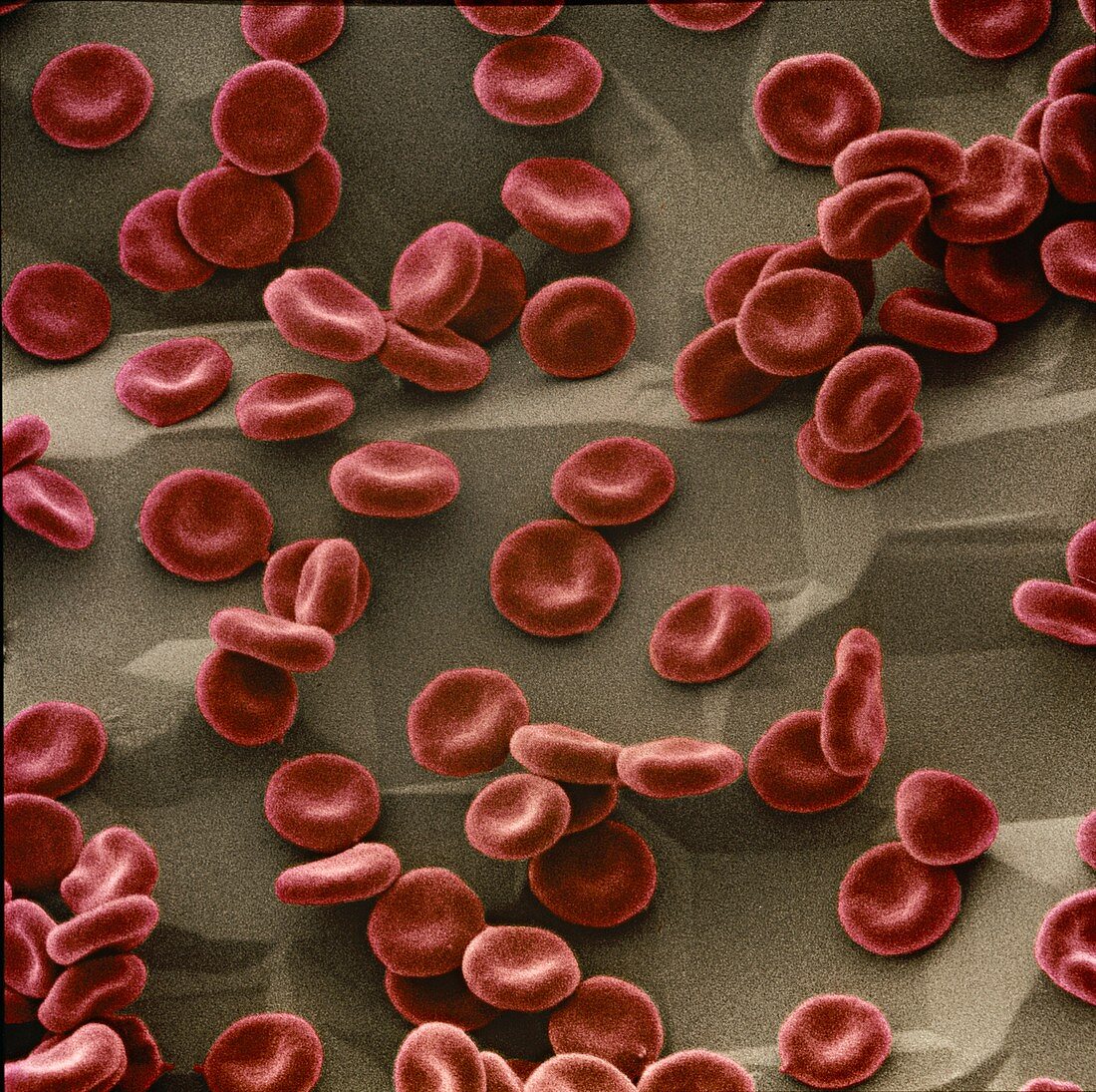 Red blood cells,SEM