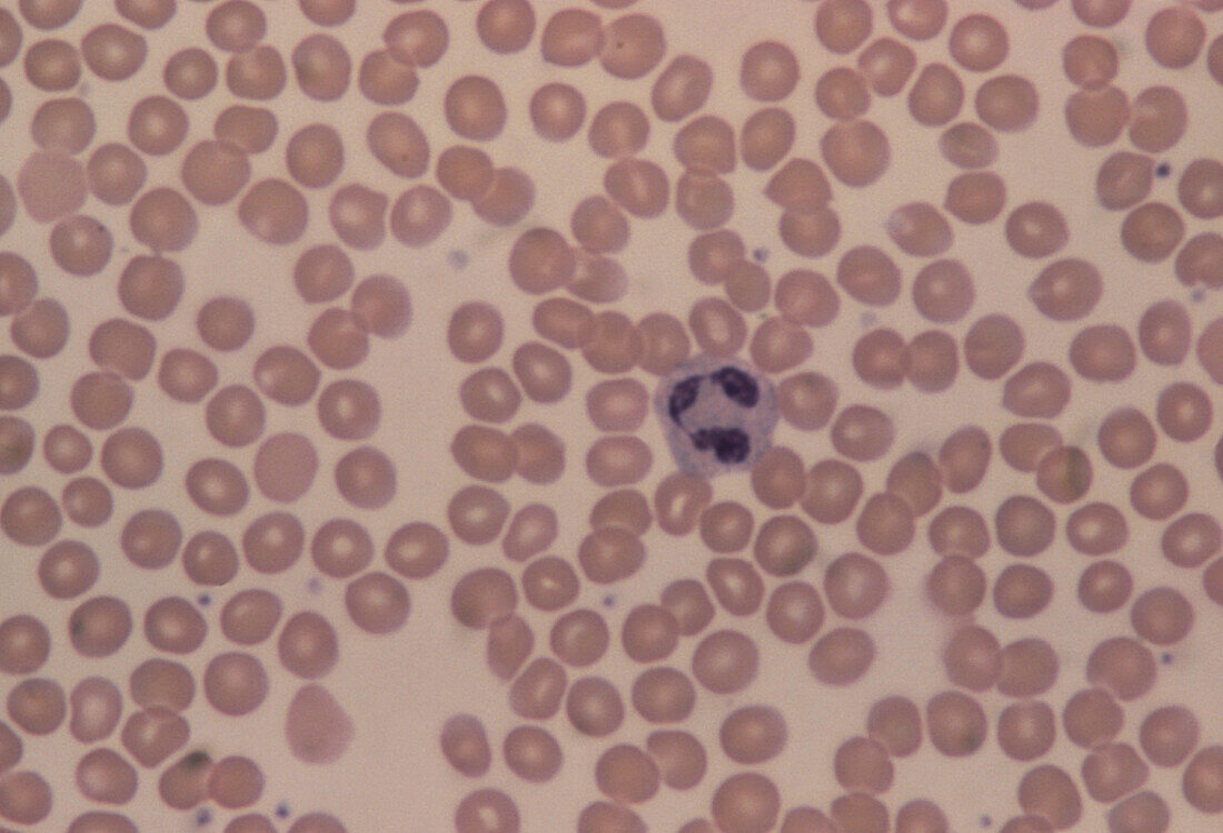 LM of human blood smear showing red & white cells