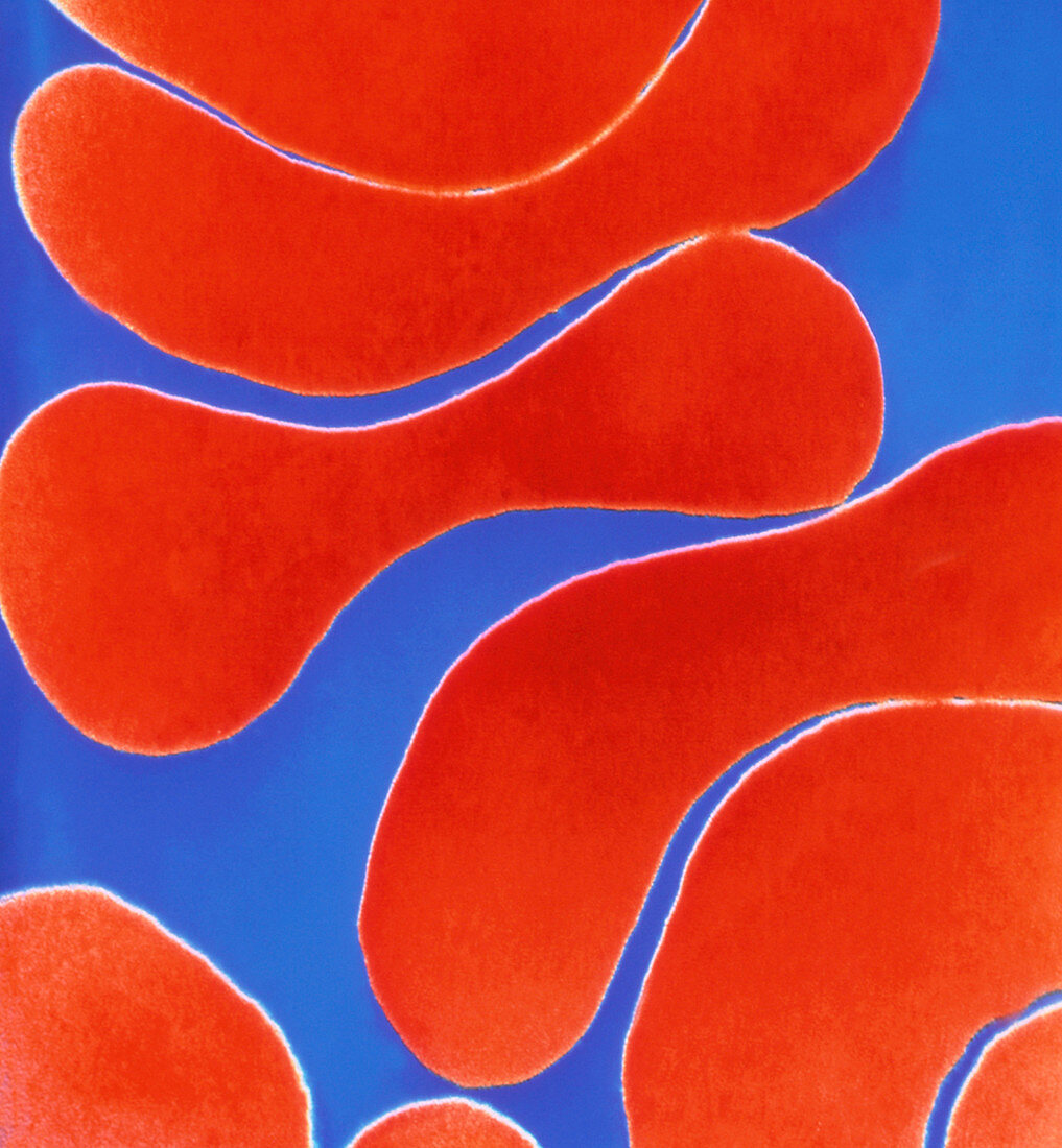 Colour TEM of red blood cells,rouleau fo