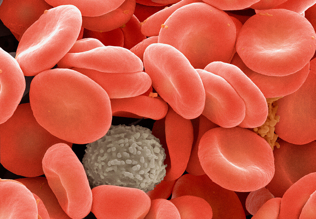 Red and white blood cells