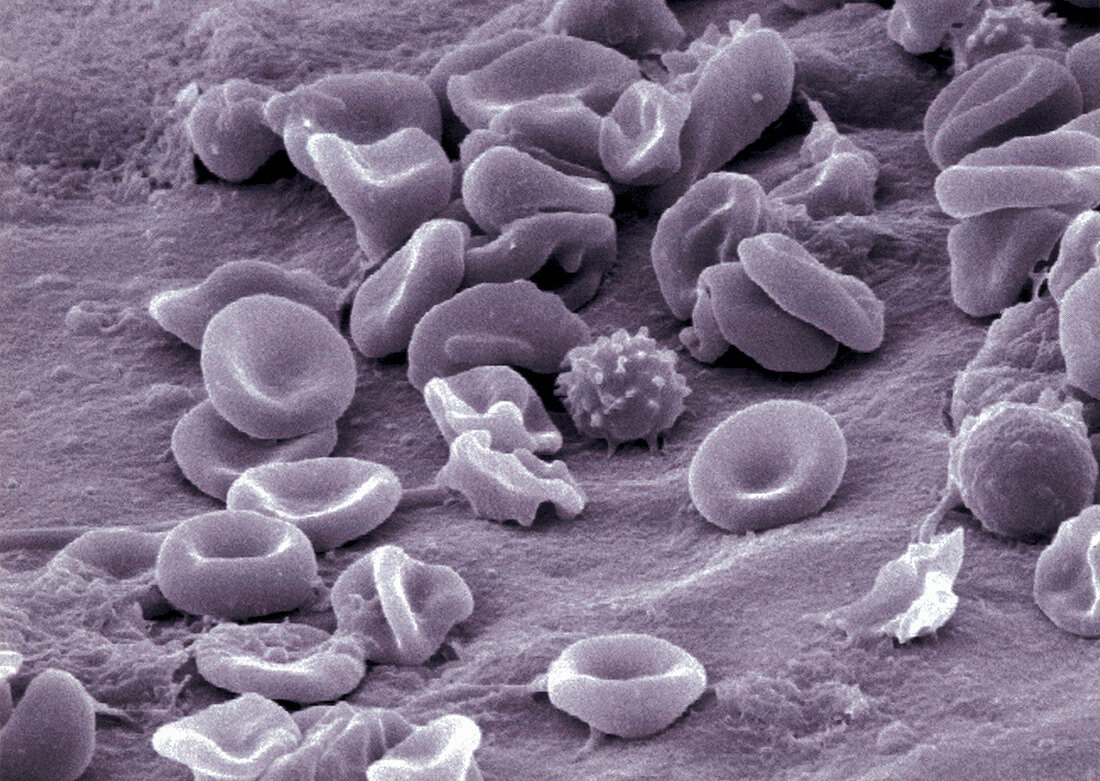 SEM of blood cells