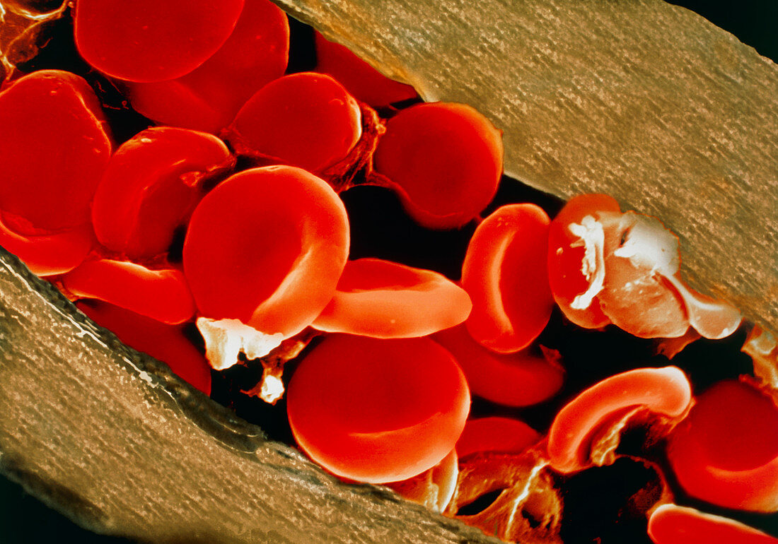 Red blood cells,SEM