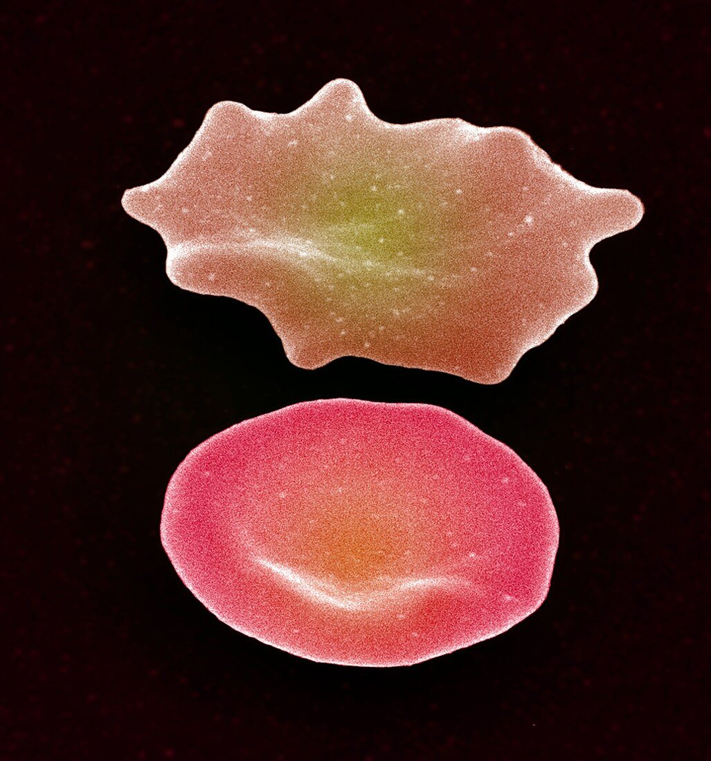 Red blood cell crenation,SEM
