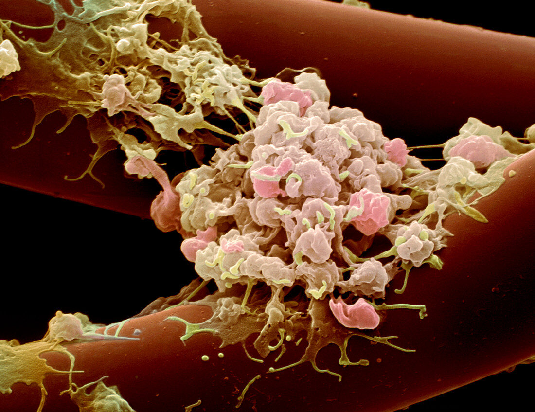 Activated platelets,SEM