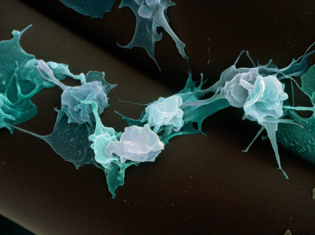 Activated platelets,SEM