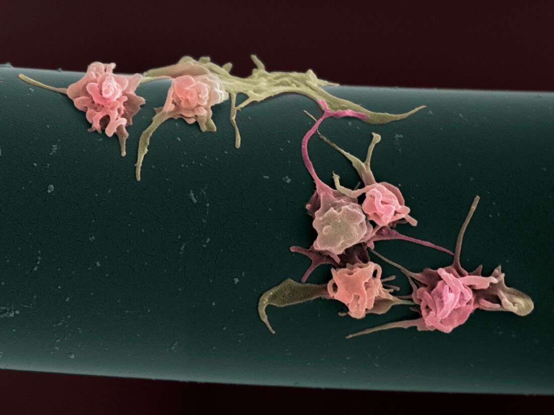 Activated platelets,SEM