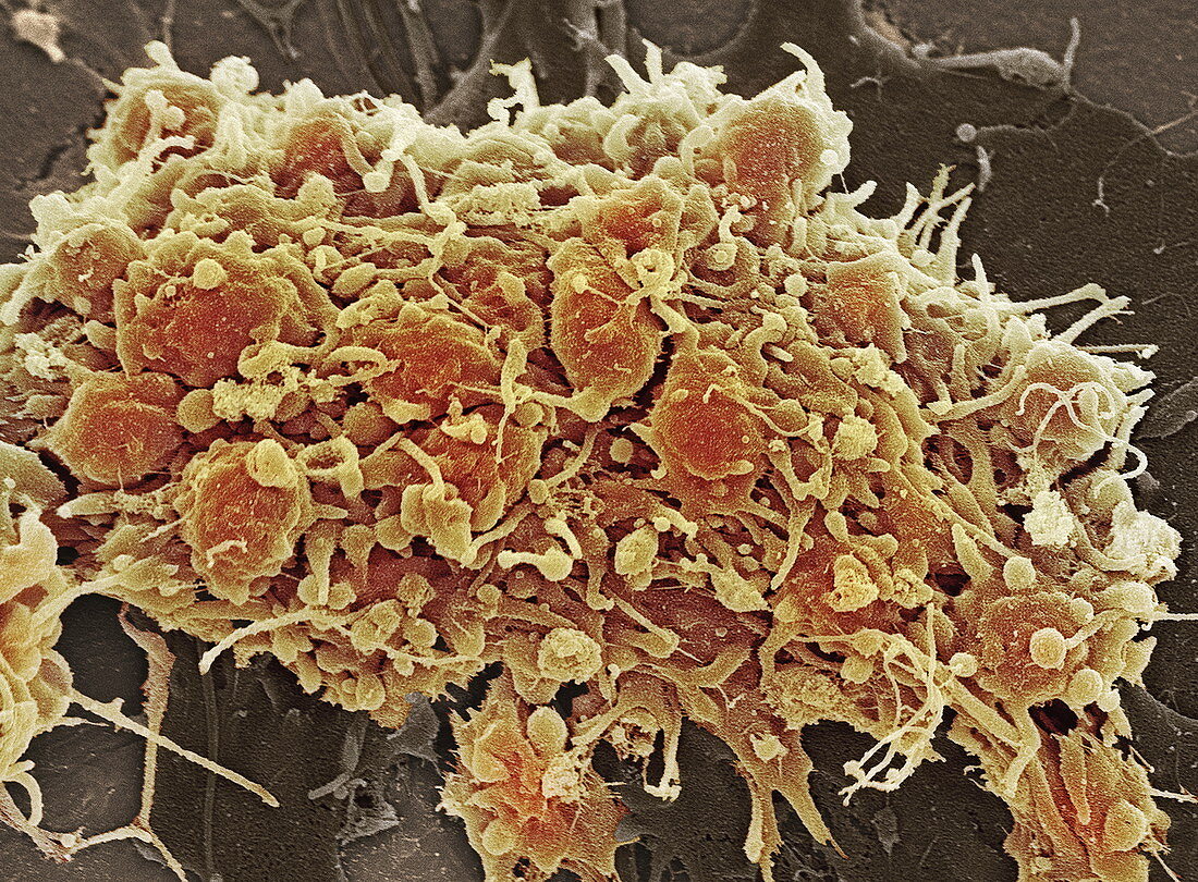 Platelets in a blood clot