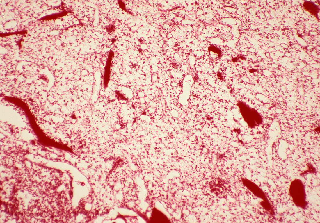Spleen pulp,light micrograph