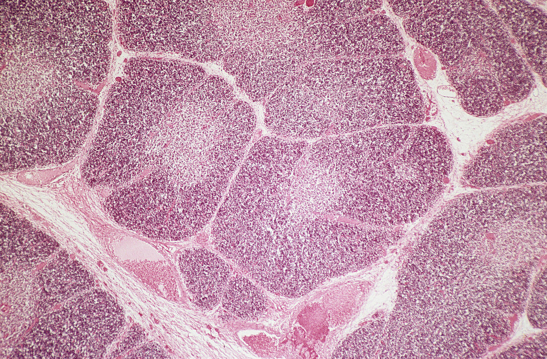 Embryonic thymus,light micrograph
