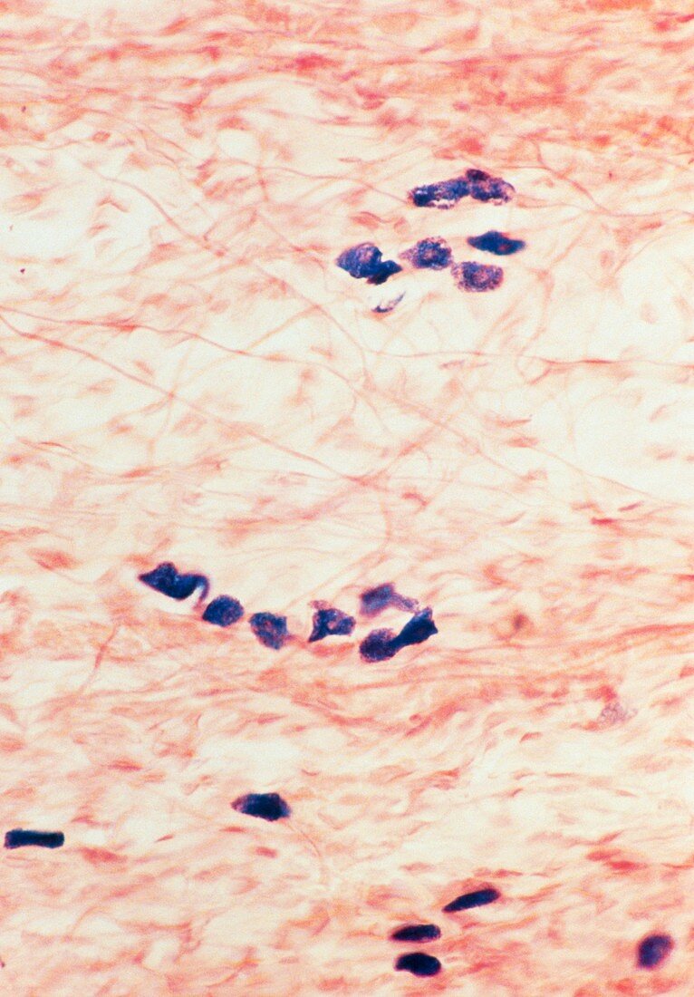 LM of mast cells in connective tissue