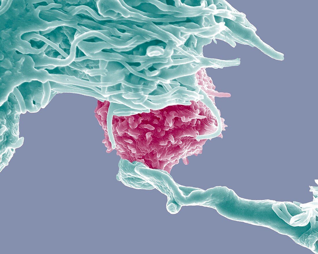 Dendritic cell and lymphocyte,SEM