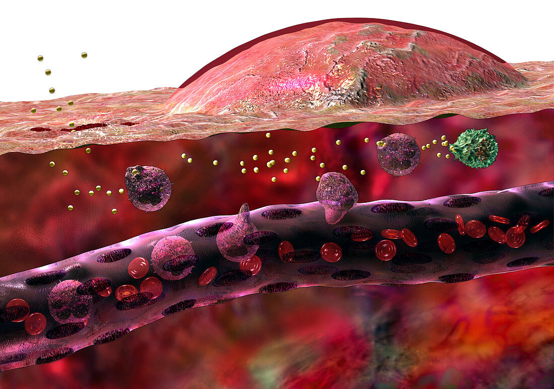 Inflammatory response