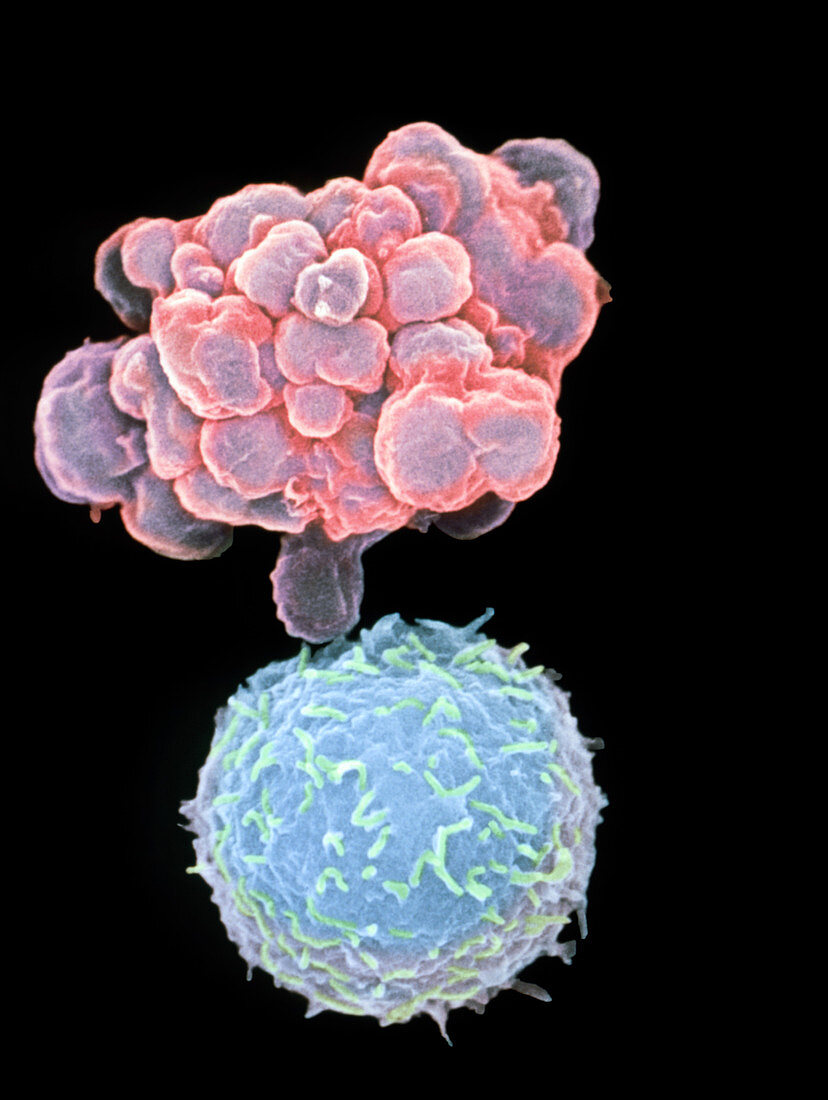 Coloured SEM of white blood cell during apoptosis
