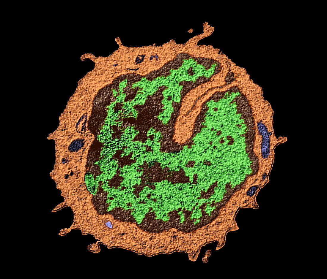 T-lymphocyte,TEM