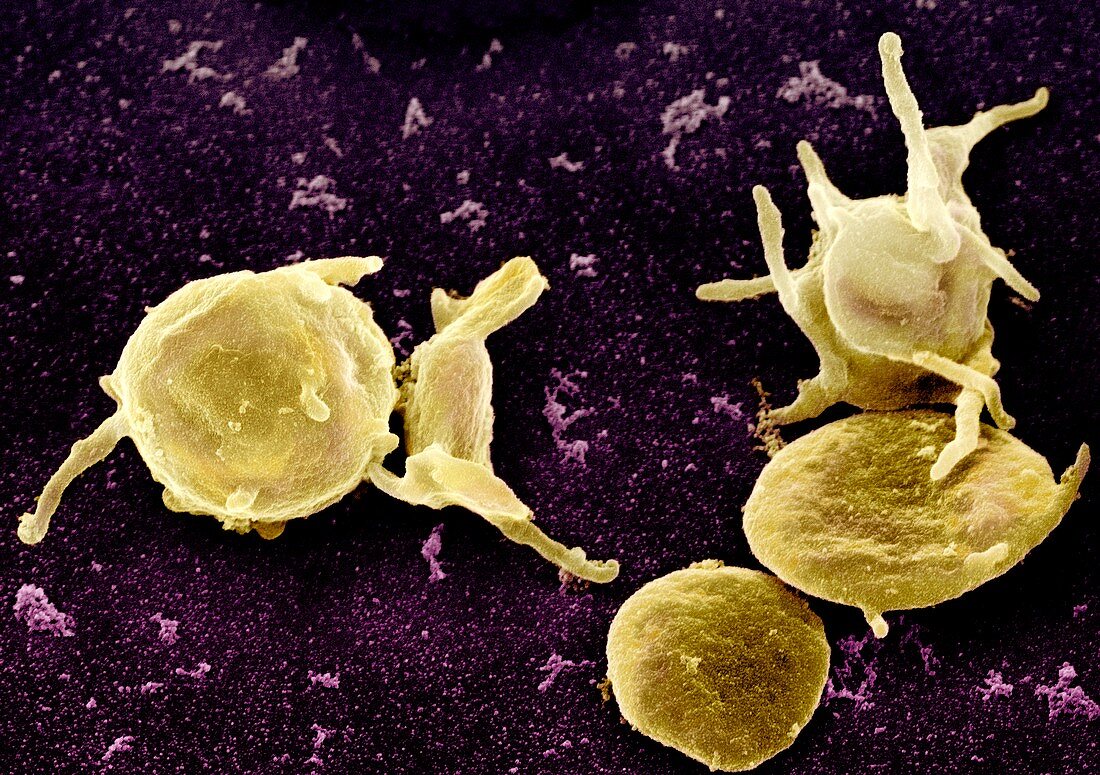 Activated platelets,SEM