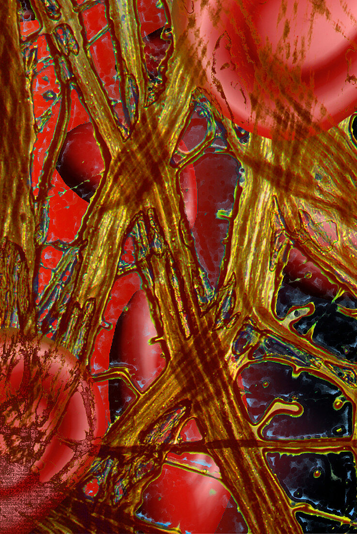 Computer artwork of red blood cells and fibrin
