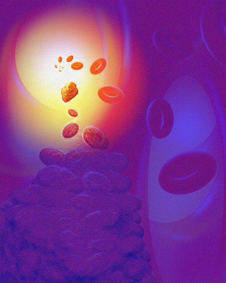 Computer artwork of a blood clot