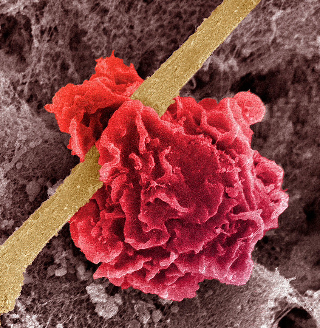 Macrophage ingesting debris,SEM