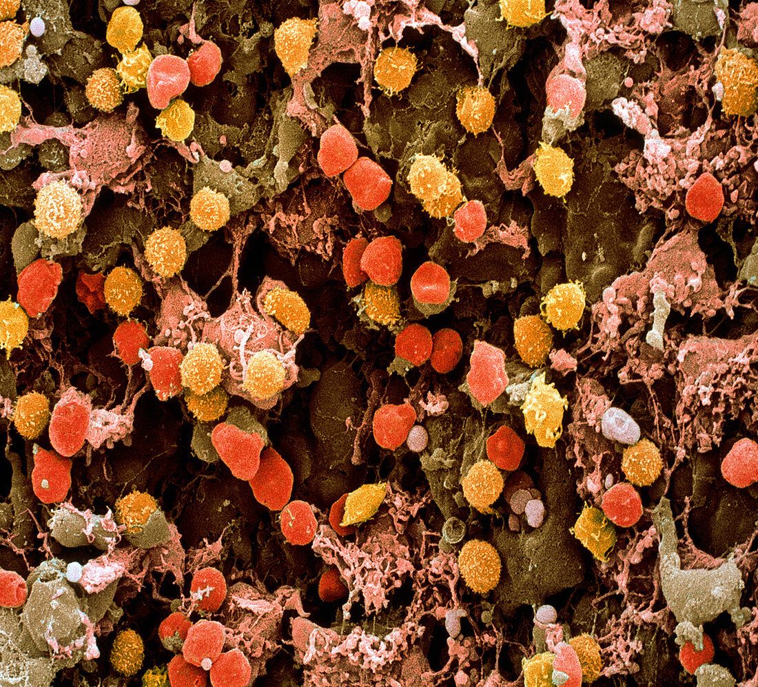 Lymph node,SEM