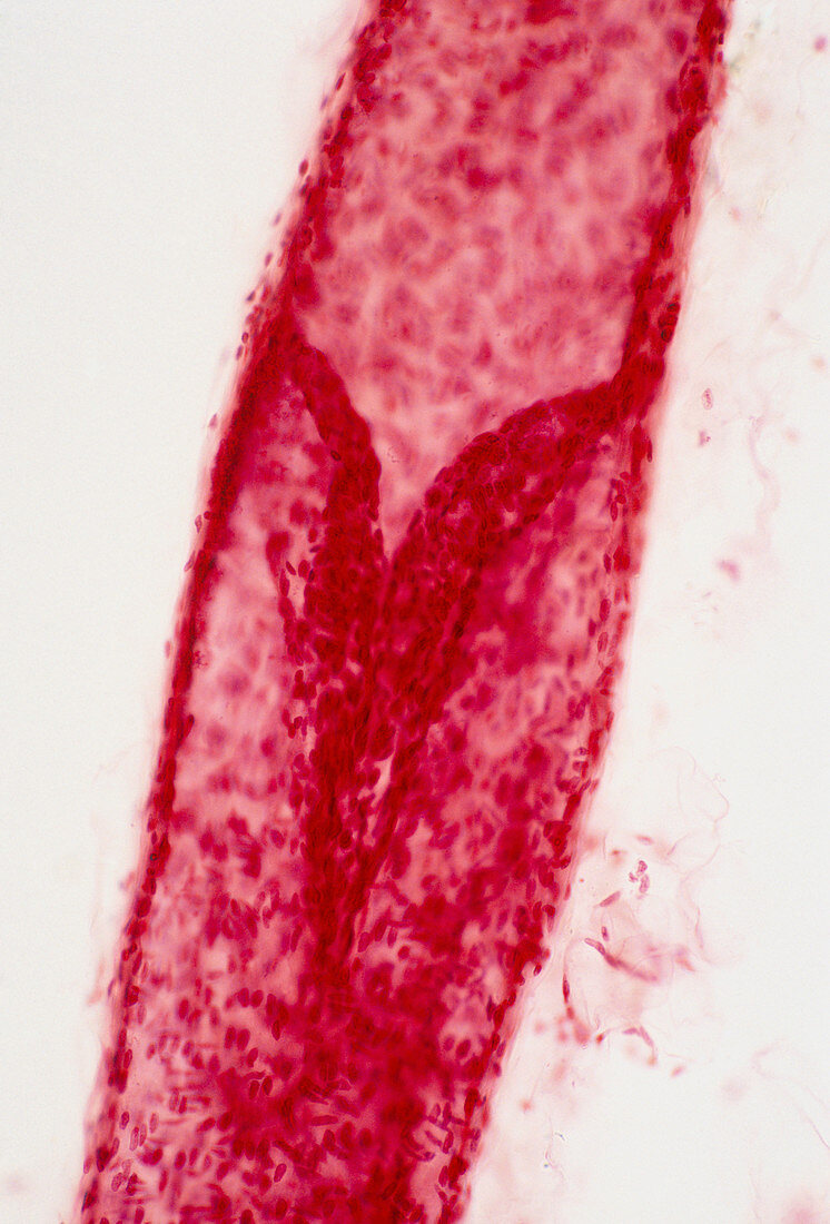 Lymphatic vessel valve,light micrograph
