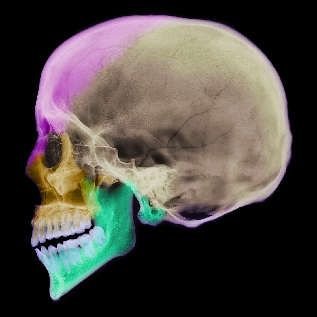 Facial nerves,X-ray