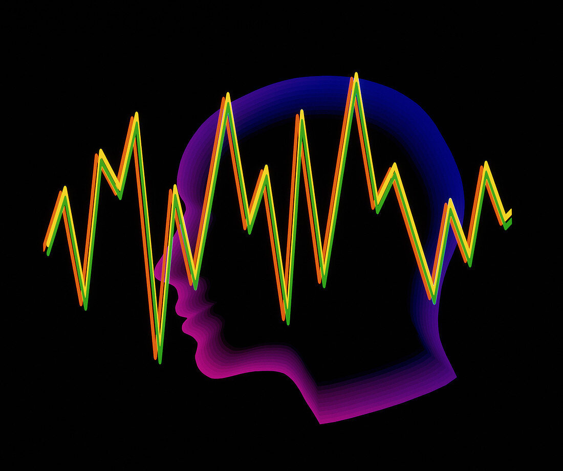 Artwork of a brainwave superimposed on a