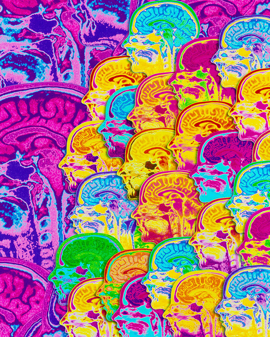 Abstract coloured MRI scans of the human brain