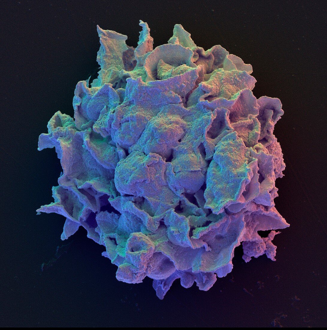 Coloured SEM of macrophage cell