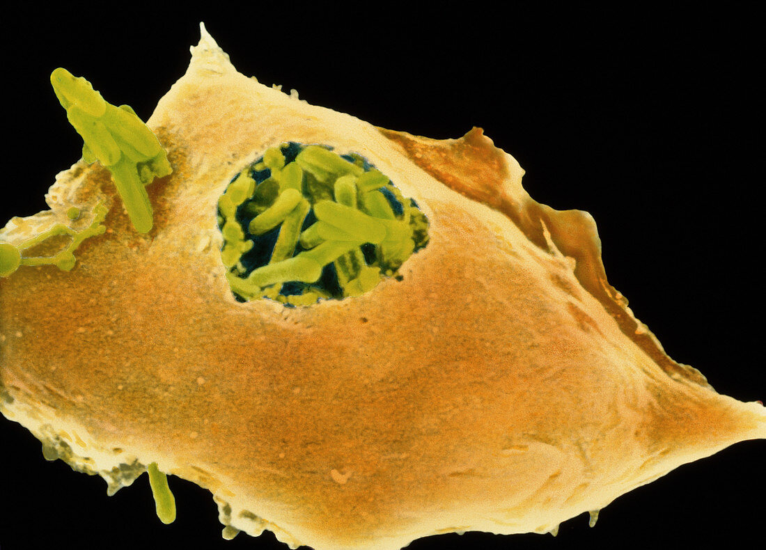 Macrophage eats TB bacteria