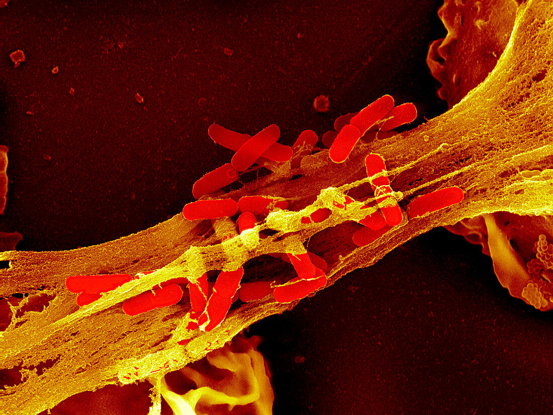 Neutrophil cell trapping bacteria,SEM