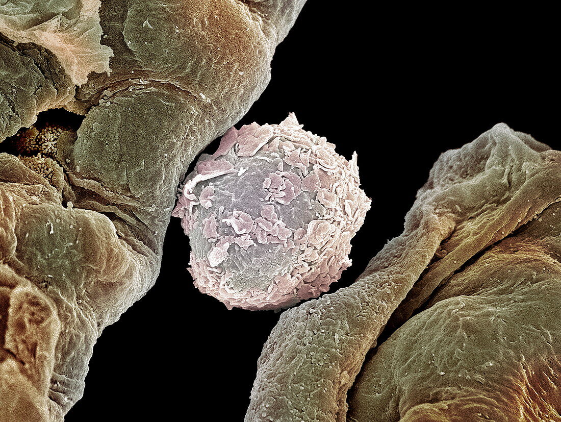 Macrophage cell in lung,SEM