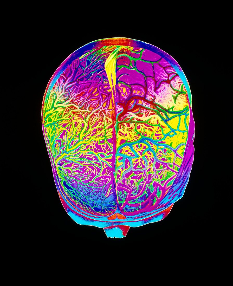 Mascagni artwork of human brain & blood vessels