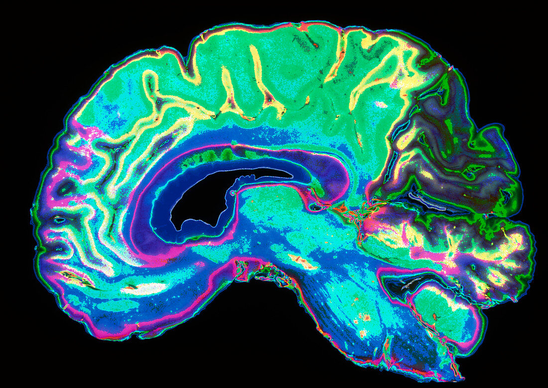 Coloured sagittal slice through a healthy brain