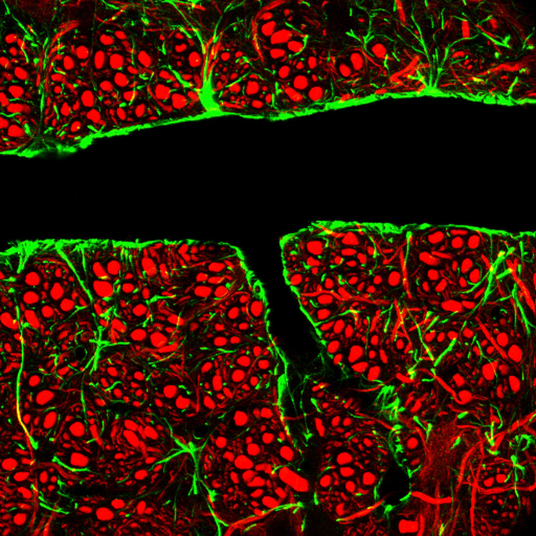 Blood-brain barrier,light micrograph