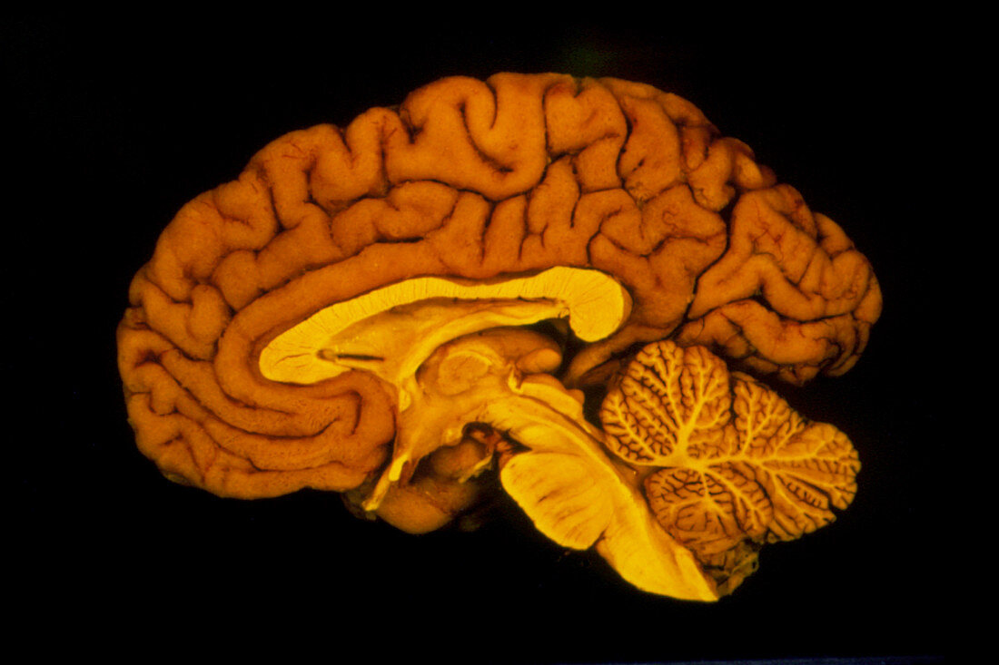 Human brain