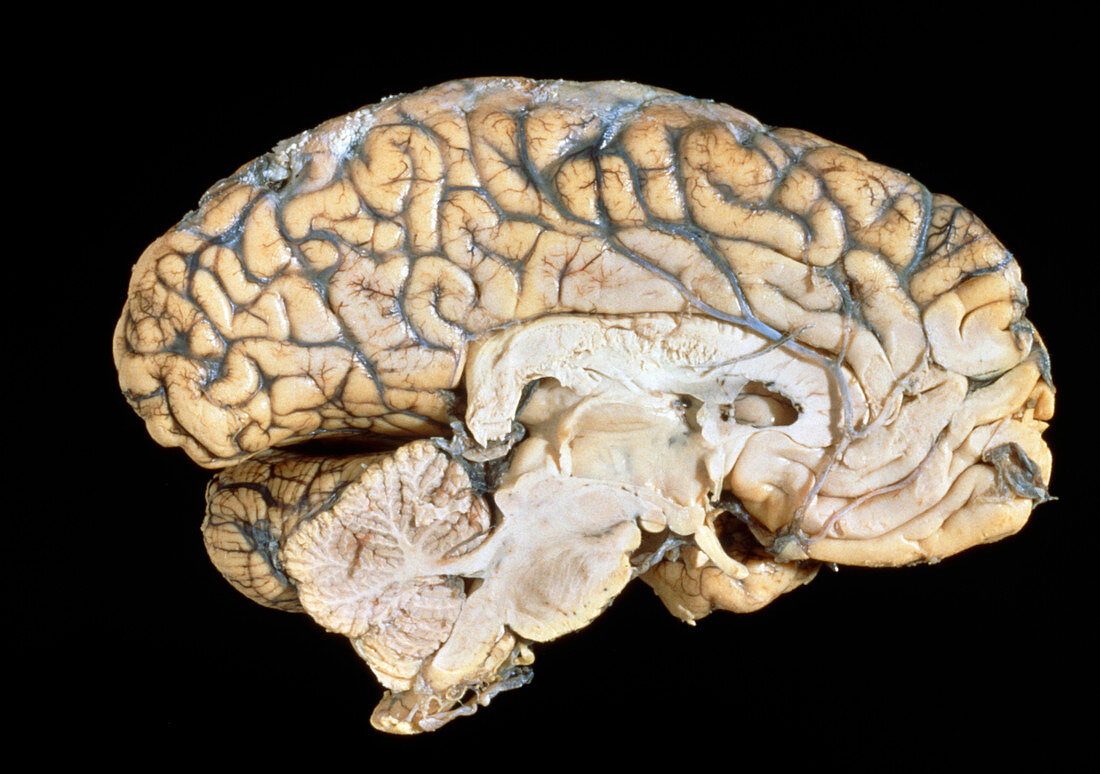 Side view of the anatomy of the human brain