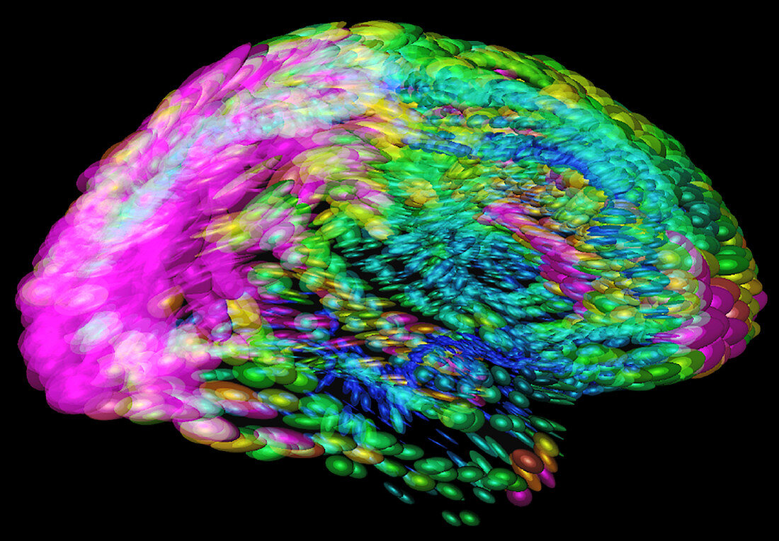 Human brain variation