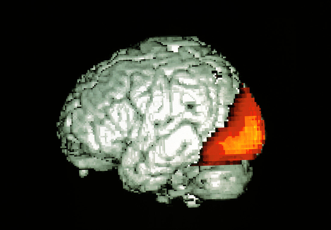 Brain viewing images