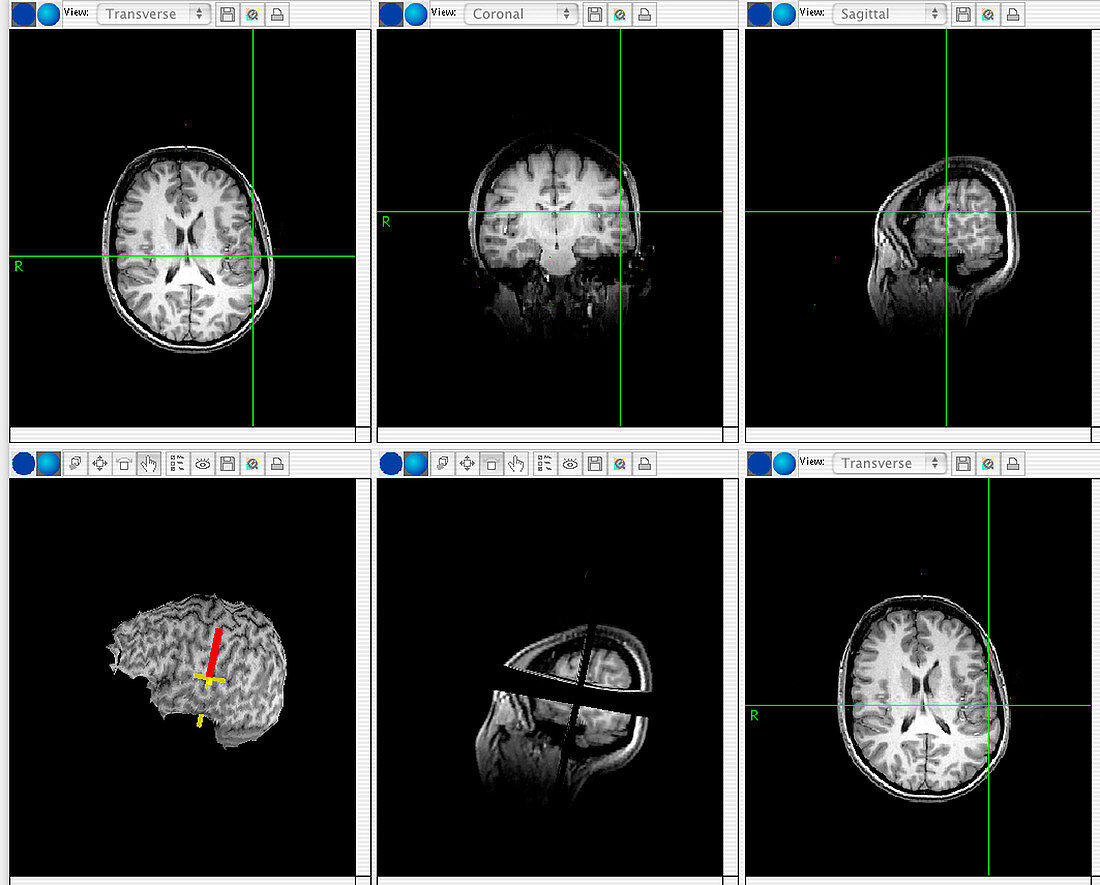 Brain mapping scans