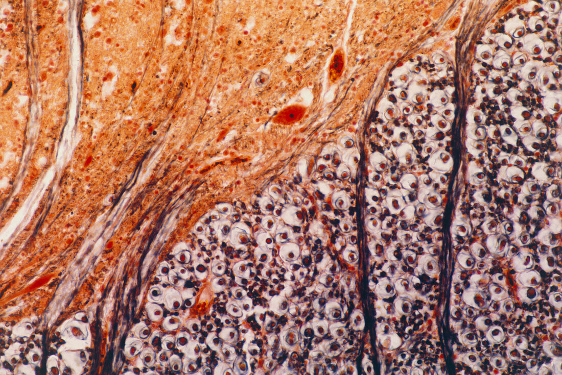 Light micrograph of human spinal cord