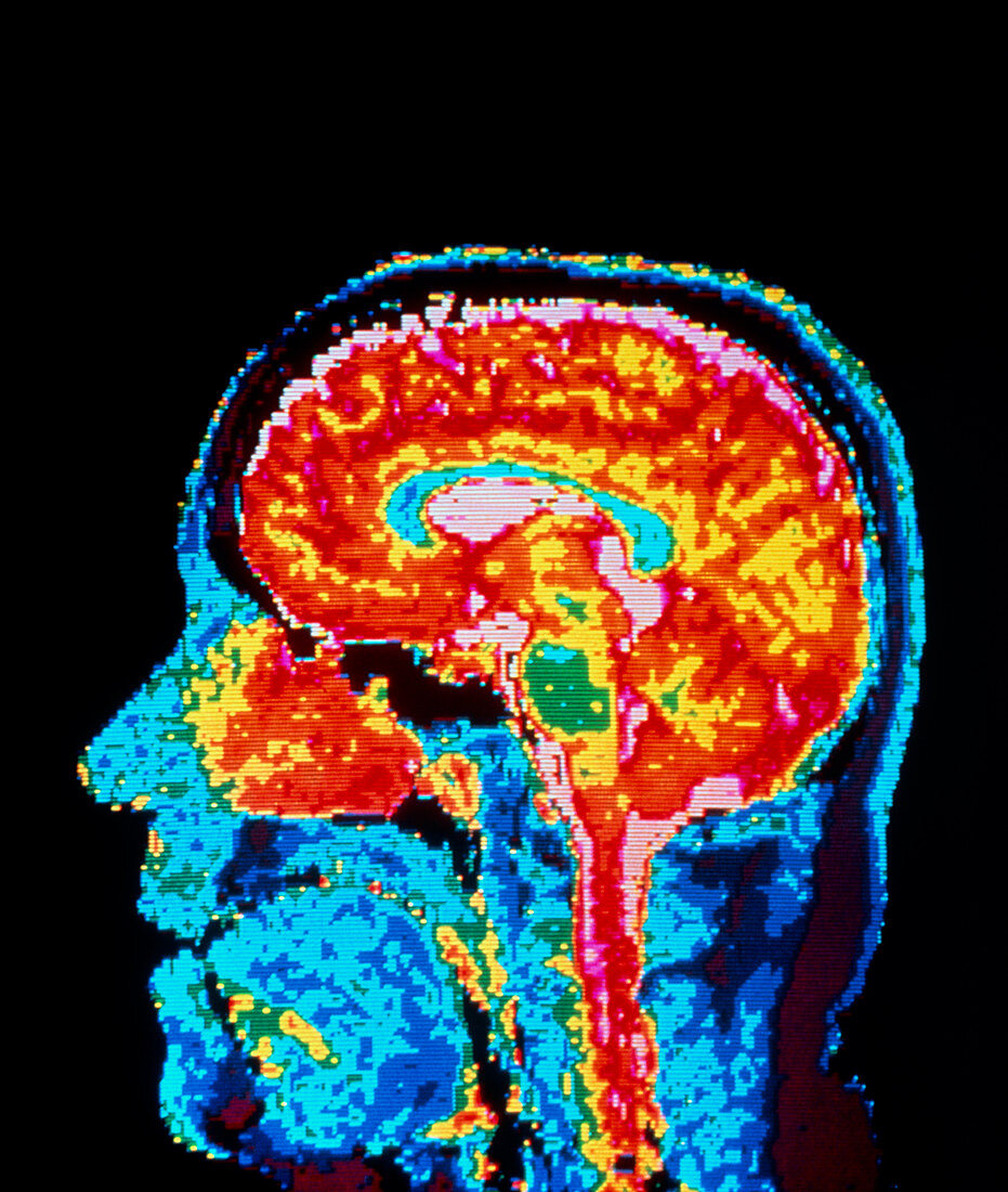 NMR image showing structures of the brain