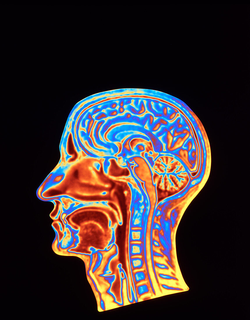 Coloured MRI scan of the human head side