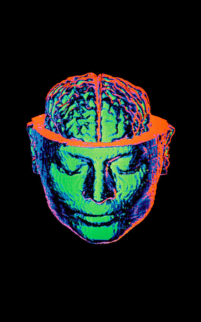 Coloured 3-D CT scan of opened head with brain