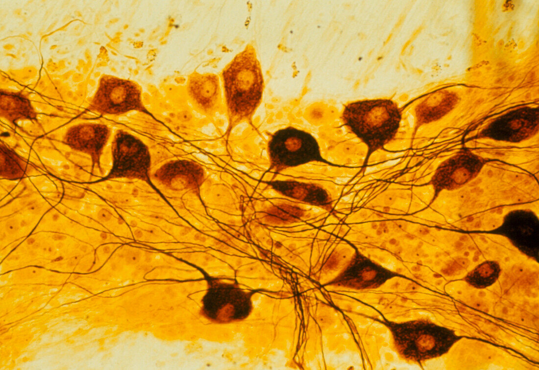 Light micrograph of neurone cell bodies