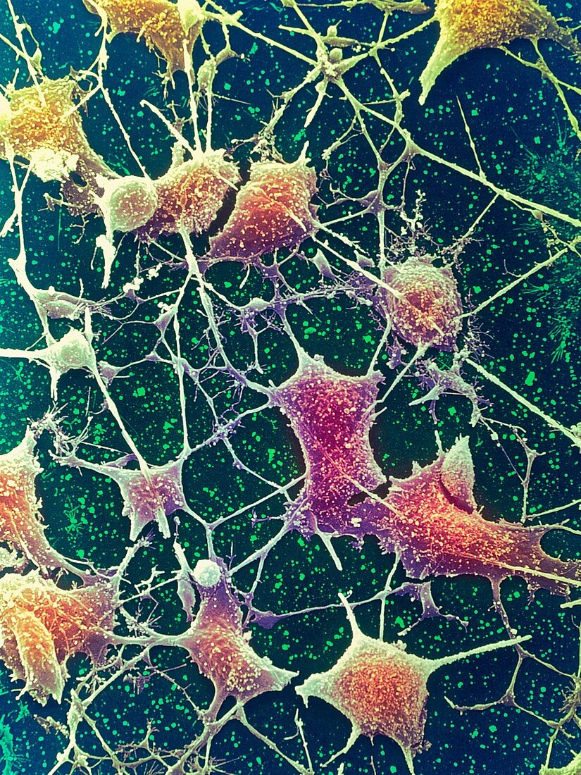 Nerve cells,SEM