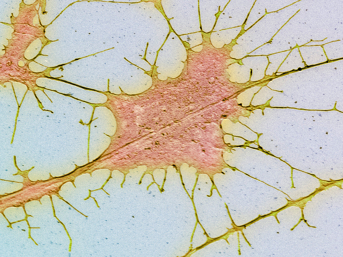 Nerve cell culture,SEM