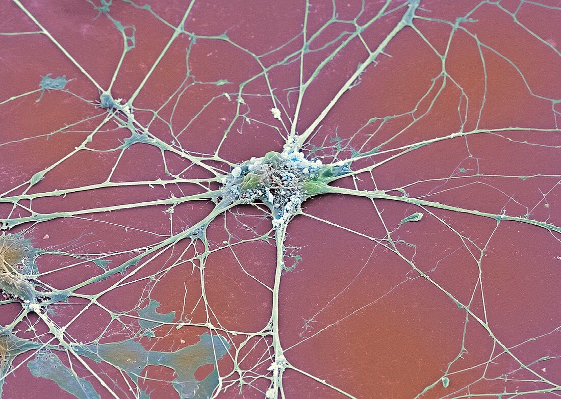 Nerve cell,SEM