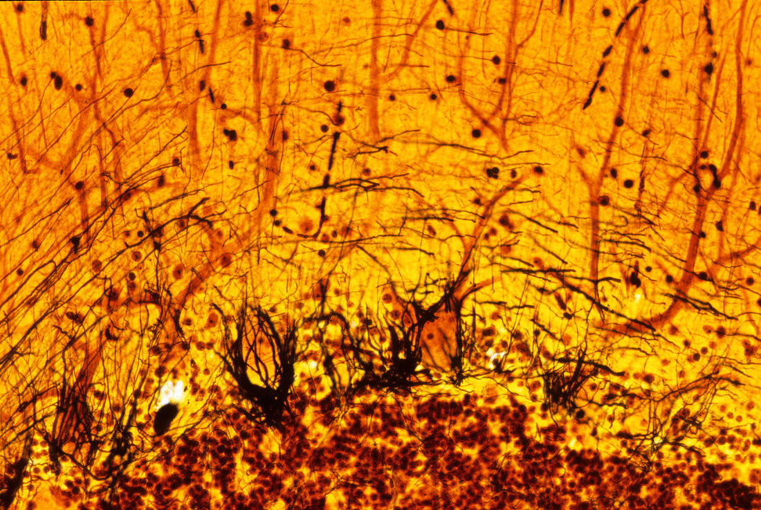 Purkinje nerve cells