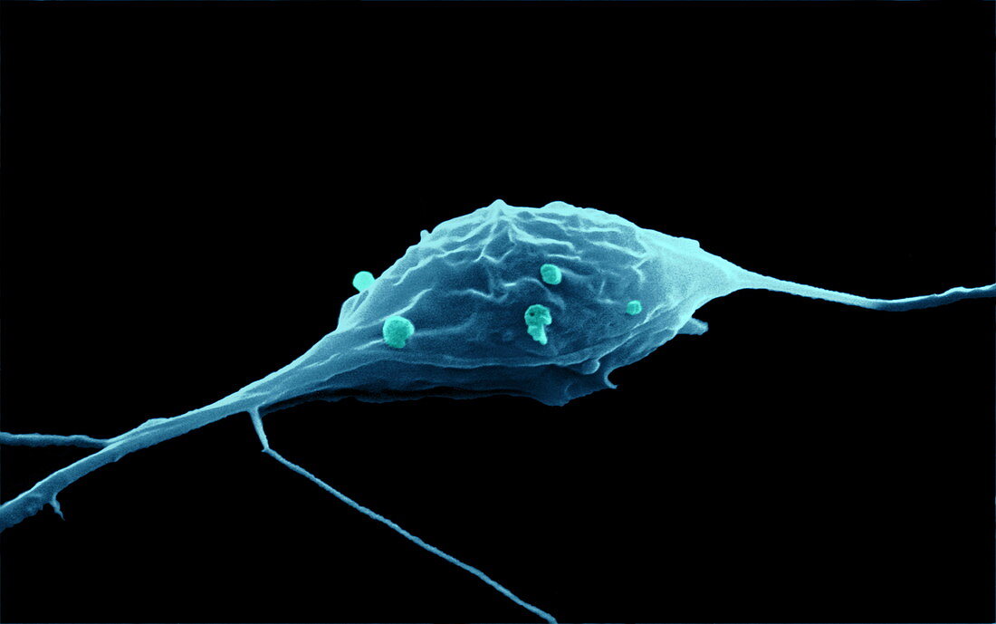 Granule nerve cell,SEM